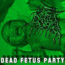 Fetus Disease : Dead Fetus Party